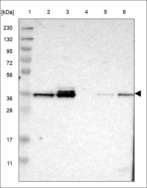 Anti-DEGS1 Antibody