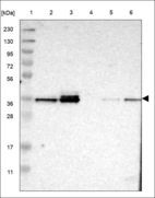 Anti-DEGS1 Antibody