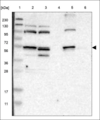 Anti-ALDH3A2 Antibody