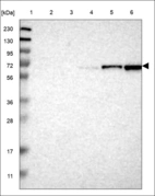 Anti-PRDM5 Antibody