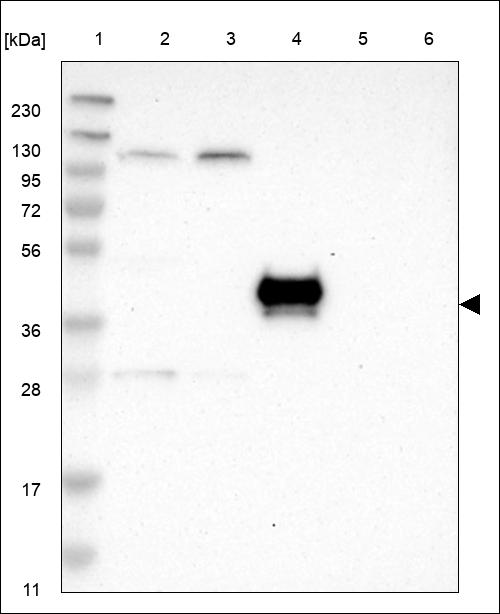 Anti-QRFPR Antibody