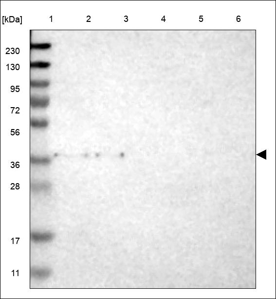 Anti-TAS2R8 Antibody