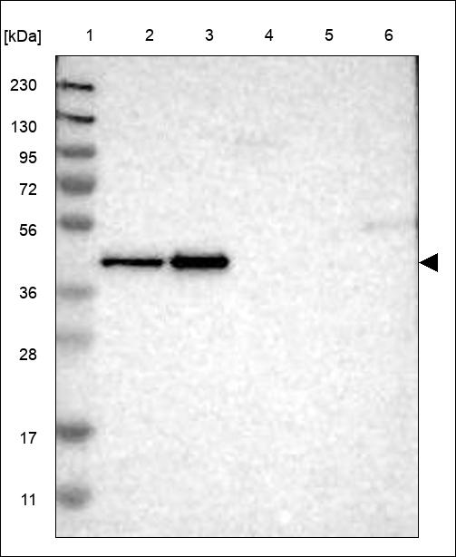 Anti-TRIB3 Antibody