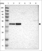 Anti-TRIB3 Antibody