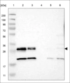 Anti-HSD17B12 Antibody