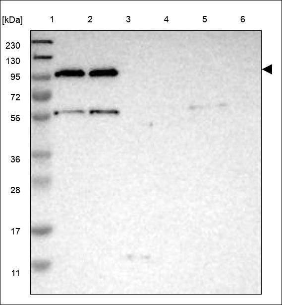 Anti-TMTC4 Antibody