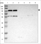Anti-TMTC4 Antibody