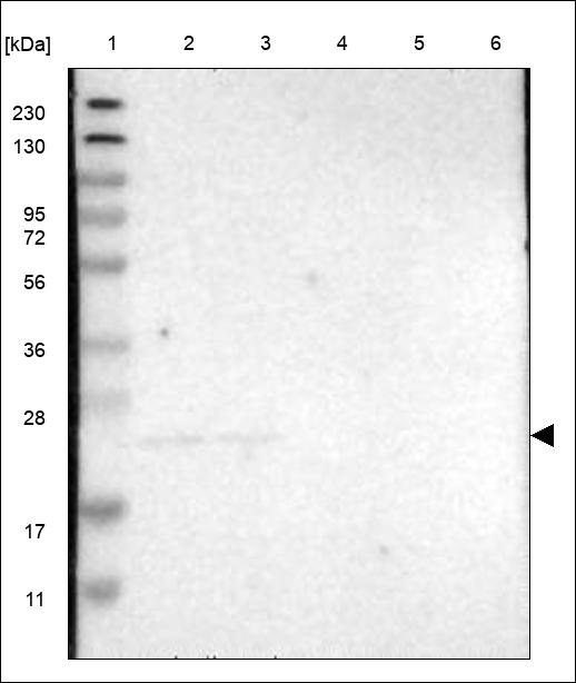 Anti-DCAKD Antibody