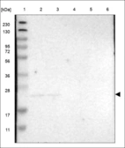 Anti-DCAKD Antibody