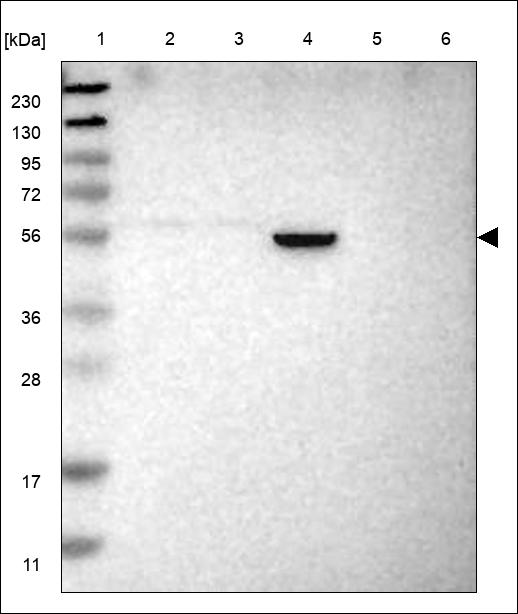 Anti-ZNF559 Antibody