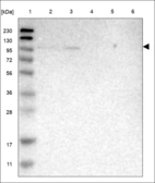 Anti-LATS2 Antibody