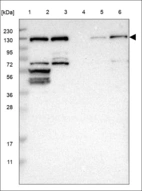 Anti-RNF20 Antibody