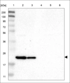 Anti-CLDN8 Antibody