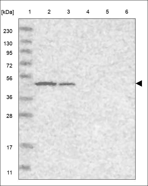 Anti-ZDHHC11B Antibody