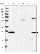 Anti-RAB3D Antibody