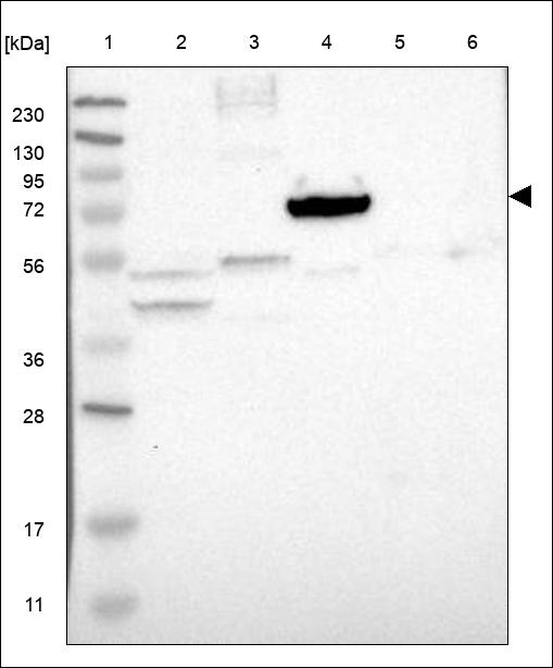 Anti-HABP2 Antibody