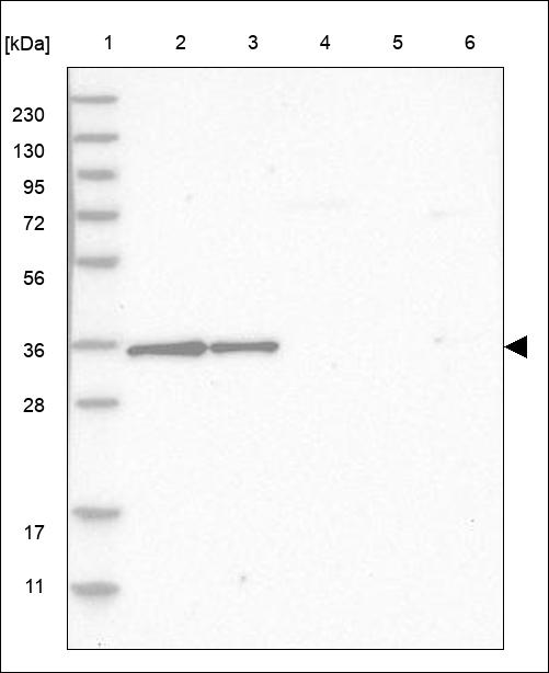Anti-FAM166A Antibody