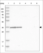 Anti-FAM166A Antibody
