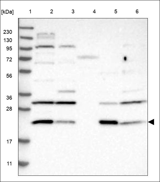 Anti-RANGRF Antibody
