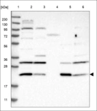 Anti-RANGRF Antibody