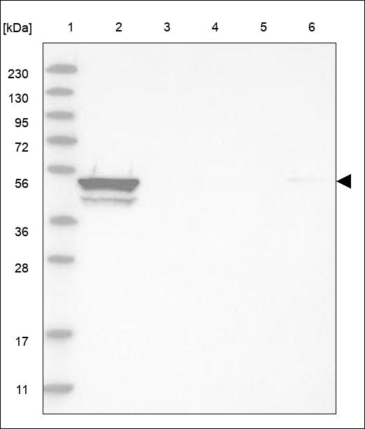 Anti-BMP3 Antibody