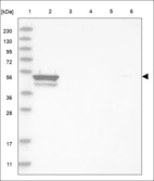 Anti-BMP3 Antibody