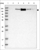 Anti-THBS1 Antibody