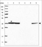 Anti-OR1B1 Antibody