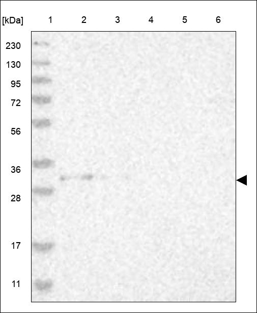 Anti-PSMC3IP Antibody