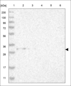 Anti-PSMC3IP Antibody