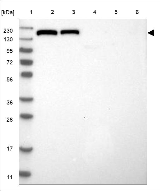 Anti-QRICH2 Antibody