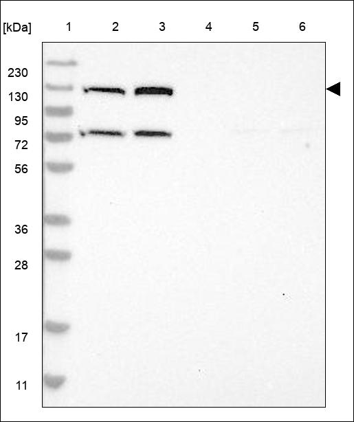 Anti-SMC5 Antibody