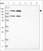 Anti-SMC5 Antibody