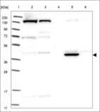 Anti-RABEPK Antibody