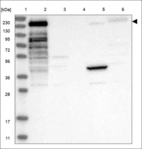 Anti-JMJD1C Antibody