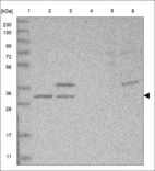 Anti-C8orf76 Antibody