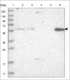 Anti-ZNF567 Antibody