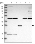 Anti-INCA1 Antibody