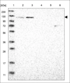 Anti-LLGL1 Antibody