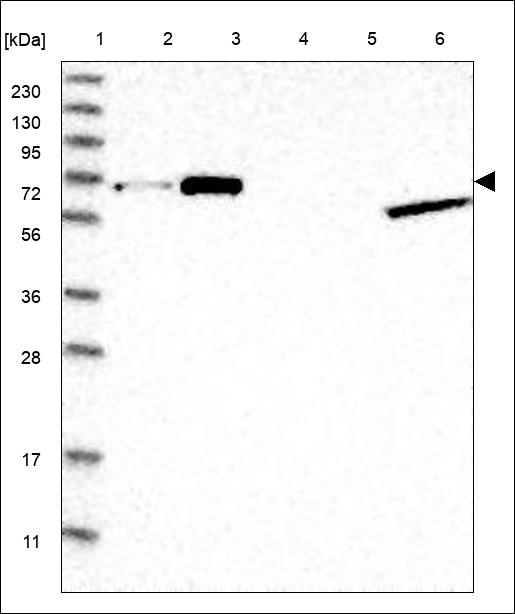 Anti-ZNF770 Antibody
