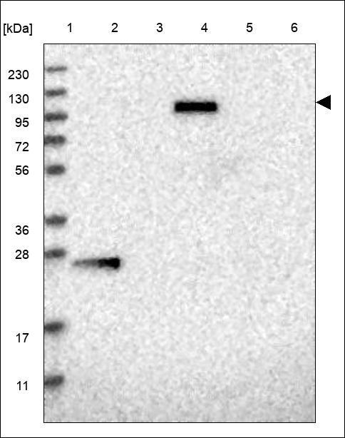 Anti-ARHGAP39 Antibody