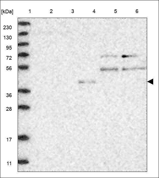 Anti-NEUROD6 Antibody