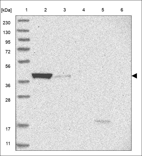 Anti-UBE3D Antibody