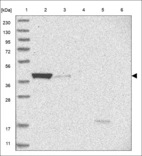 Anti-UBE3D Antibody