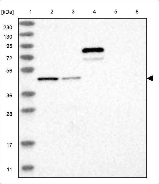 Anti-FBRS Antibody