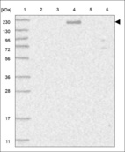 Anti-ABCC3 Antibody