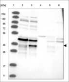 Anti-RRP15 Antibody