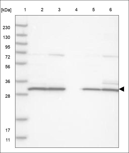 Anti-CCND1 Antibody
