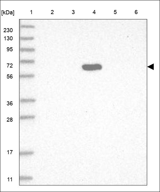 Anti-C8A Antibody