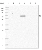Anti-C8A Antibody